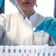 Scientist wearing blue gloves uses a pipette to transfer colored liquids