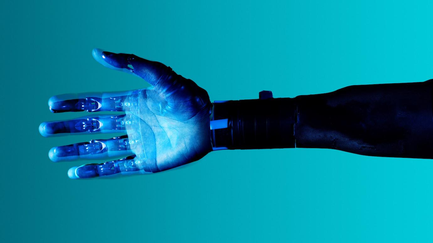 Frontiers  Designing Prosthetic Hands With Embodied Intelligence