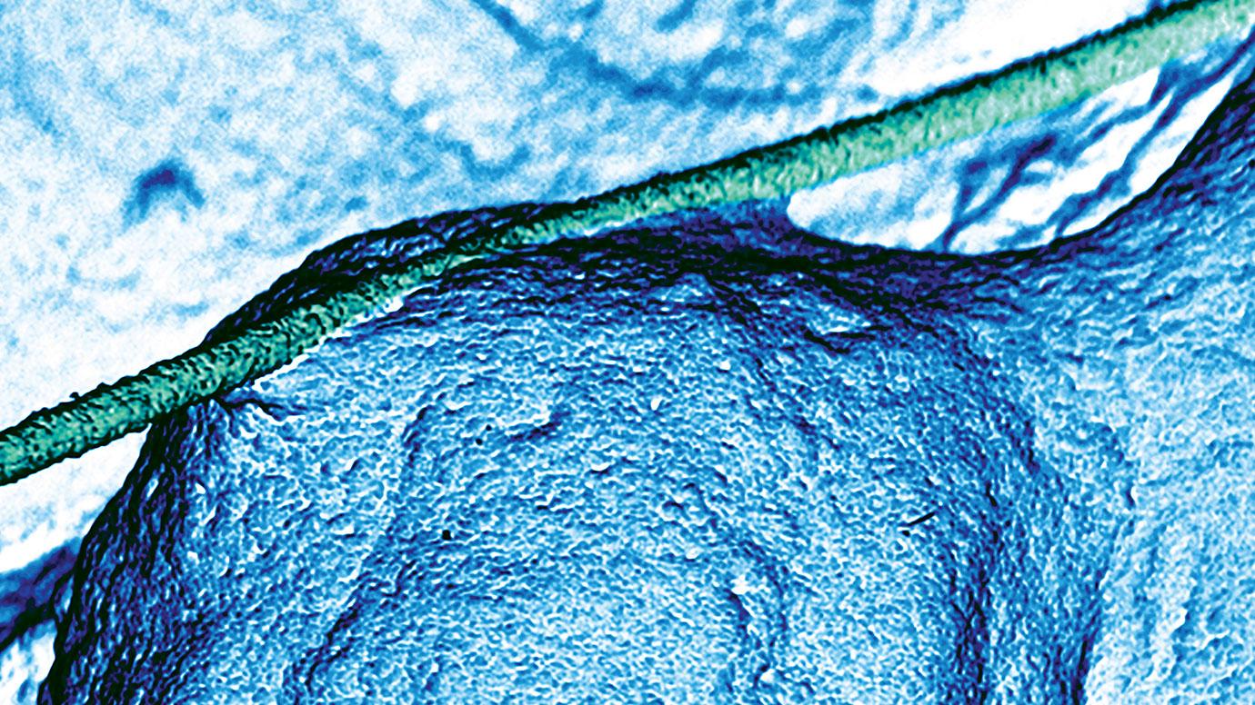 A scanning electron microscope image that shows a neuron with a silicon nanowire, which creates the appearance of a window covered in ice.