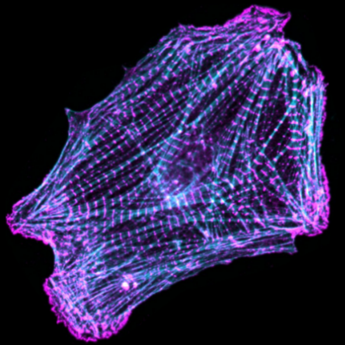 Heart muscle cell