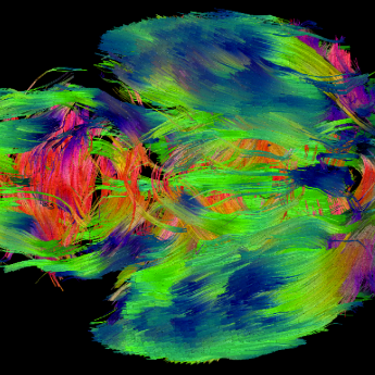 Tractography mouse