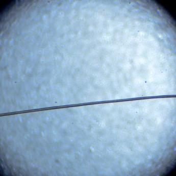 A single strand of hair seen under a microscope