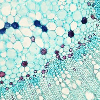 Microscopic view showing cells with blue and purple staining.