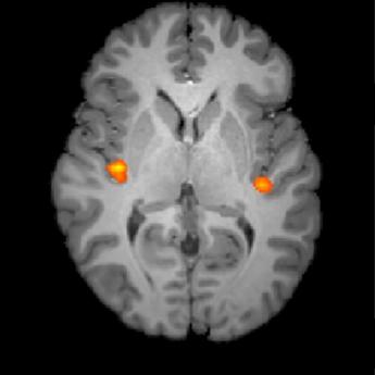 Brain scans 