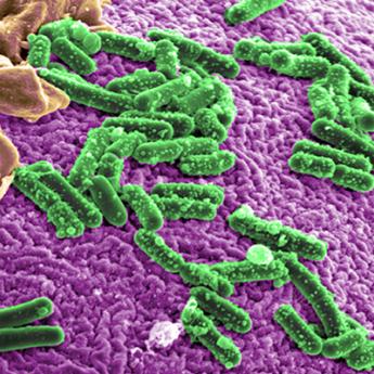 Human gut microbiome under the microscope