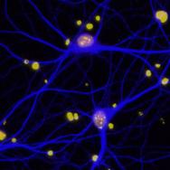 Neurons in mouse brain