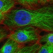 Stress Fibers and Microtubules in Human Breast Cancer Cells.