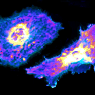 fluroscent-marked images of two cells with internal structure visible