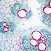 Blue and red microscope close-up of a slice of stem showing many different cells crowded together in intricate patterns.